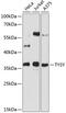 Thymidylate Synthetase antibody, 13-007, ProSci, Western Blot image 