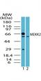 Mitogen-Activated Protein Kinase Kinase Kinase 2 antibody, PA5-23151, Invitrogen Antibodies, Western Blot image 