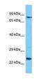 DDB1 And CUL4 Associated Factor 16 antibody, orb327218, Biorbyt, Western Blot image 