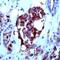 Mucin 1, Cell Surface Associated antibody, MA1-38209, Invitrogen Antibodies, Immunohistochemistry paraffin image 