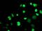 Myocyte-specific enhancer factor 2C antibody, MA5-25477, Invitrogen Antibodies, Immunocytochemistry image 