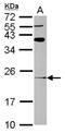 ADP Ribosylation Factor Like GTPase 8A antibody, NBP2-15466, Novus Biologicals, Western Blot image 