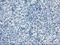 Branched Chain Keto Acid Dehydrogenase Kinase antibody, NBP1-47664, Novus Biologicals, Immunohistochemistry frozen image 