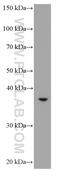 Asialoglycoprotein Receptor 2 antibody, 66831-1-Ig, Proteintech Group, Western Blot image 