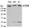 Mechanistic Target Of Rapamycin Kinase antibody, 79-366, ProSci, Western Blot image 