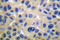 Collagen Type II Alpha 1 Chain antibody, LS-C175971, Lifespan Biosciences, Immunohistochemistry paraffin image 