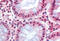 Methyl-CpG Binding Domain Protein 2 antibody, MBS242656, MyBioSource, Immunohistochemistry frozen image 