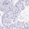 Zymogen Granule Protein 16B antibody, NBP1-81699, Novus Biologicals, Immunohistochemistry paraffin image 