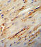 Collagen Type V Alpha 1 Chain antibody, LS-C166929, Lifespan Biosciences, Immunohistochemistry paraffin image 