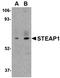 STEAP Family Member 1 antibody, orb74871, Biorbyt, Western Blot image 