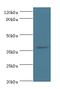 Histone Deacetylase 11 antibody, MBS1496752, MyBioSource, Western Blot image 