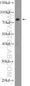 RING finger protein 219 antibody, 24988-1-AP, Proteintech Group, Western Blot image 