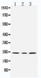 Succinate Dehydrogenase Complex Subunit C antibody, PA5-79966, Invitrogen Antibodies, Western Blot image 