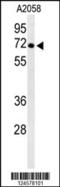 ATPase H+ Transporting V1 Subunit A antibody, 64-110, ProSci, Western Blot image 