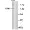 MN1 Proto-Oncogene, Transcriptional Regulator antibody, A06367, Boster Biological Technology, Western Blot image 