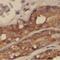 N-Acylsphingosine Amidohydrolase 1 antibody, FNab00618, FineTest, Immunohistochemistry frozen image 