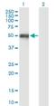 3-Oxoacid CoA-Transferase 1 antibody, H00005019-B01P, Novus Biologicals, Western Blot image 