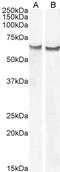 FZD2 antibody, 46-844, ProSci, Enzyme Linked Immunosorbent Assay image 