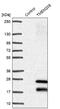 Transmembrane Protein 208 antibody, NBP1-92519, Novus Biologicals, Western Blot image 