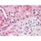 HIF1-alpha antibody, BML-SA287-0100, Enzo Life Sciences, Immunohistochemistry paraffin image 