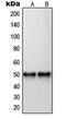 Retinoic Acid Receptor Beta antibody, orb214497, Biorbyt, Western Blot image 