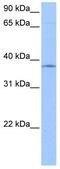 Sprouty RTK Signaling Antagonist 2 antibody, GTX33687, GeneTex, Western Blot image 