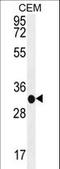 Beta-1,3-Glucuronyltransferase 3 antibody, LS-C156709, Lifespan Biosciences, Western Blot image 