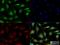 Homeodomain Interacting Protein Kinase 3 antibody, NBP2-24521, Novus Biologicals, Immunofluorescence image 