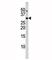 Cyclin Dependent Kinase Inhibitor 1B antibody, F48426-0.4ML, NSJ Bioreagents, Western Blot image 