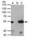 Estrogen Related Receptor Alpha antibody, GTX108166, GeneTex, Immunoprecipitation image 
