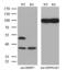 RB Binding Protein 7, Chromatin Remodeling Factor antibody, MA5-25715, Invitrogen Antibodies, Western Blot image 