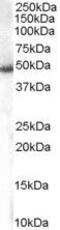 Sorting Nexin 5 antibody, PA5-18230, Invitrogen Antibodies, Western Blot image 