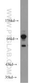 GTP Binding Protein 1 antibody, 16374-1-AP, Proteintech Group, Western Blot image 