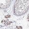 Coiled-Coil Domain Containing 73 antibody, NBP1-90689, Novus Biologicals, Immunohistochemistry paraffin image 
