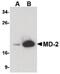 Lymphocyte Antigen 96 antibody, LS-C144483, Lifespan Biosciences, Western Blot image 