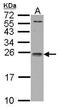 Interleukin 1 Receptor Antagonist antibody, TA308778, Origene, Western Blot image 