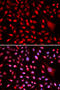 Core-Binding Factor Subunit Beta antibody, 19-574, ProSci, Immunofluorescence image 