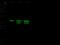 Thymidylate Synthetase antibody, 102236-T36, Sino Biological, Western Blot image 