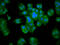 Muscleblind-like protein 3 antibody, LS-C680829, Lifespan Biosciences, Immunofluorescence image 