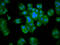 Muscleblind Like Splicing Regulator 3 antibody, LS-C680829, Lifespan Biosciences, Immunofluorescence image 