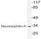 Neurexophilin 4 antibody, AP21080PU-N, Origene, Western Blot image 