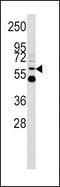 Testosterone, dihydrotestosterone, and beta-estradiol-specific UDPGT antibody, 62-285, ProSci, Western Blot image 