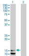 Natriuretic Peptide B antibody, LS-B12936, Lifespan Biosciences, Western Blot image 