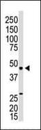 Sphingosine-1-Phosphate Receptor 3 antibody, PA5-13129, Invitrogen Antibodies, Western Blot image 