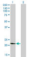 Visinin Like 1 antibody, LS-C198434, Lifespan Biosciences, Western Blot image 