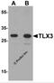 T Cell Leukemia Homeobox 3 antibody, 7375, ProSci, Western Blot image 