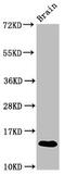 S100 Calcium Binding Protein A9 antibody, LS-C319039, Lifespan Biosciences, Western Blot image 