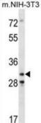 Cyclin Dependent Kinase 4 antibody, abx028579, Abbexa, Western Blot image 