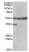 Lymphocyte-specific protein 1 antibody, orb20459, Biorbyt, Western Blot image 