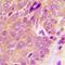Spleen Associated Tyrosine Kinase antibody, orb214637, Biorbyt, Immunohistochemistry paraffin image 